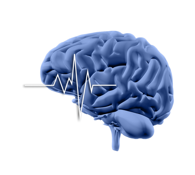 Cerebro en 3D con electro